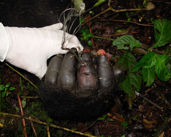 finger caught in wire snare being treated by doctors