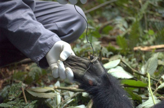 doctor removing wire snare from hand